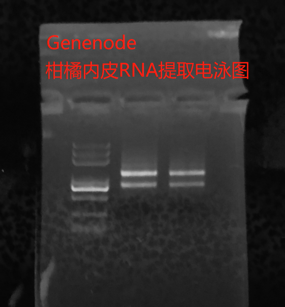 柑橘內(nèi)皮RNA電泳圖2